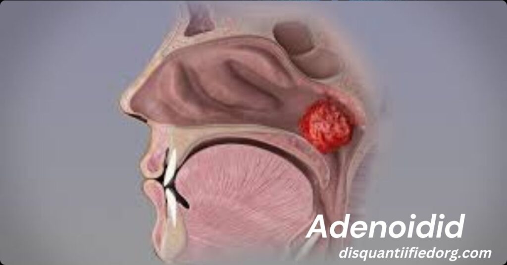 Adenoidid